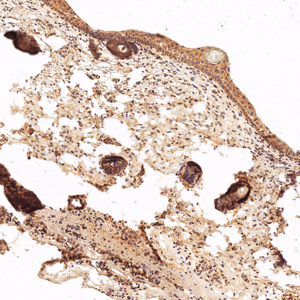 sars-cov-2 gene expression in a human fetus